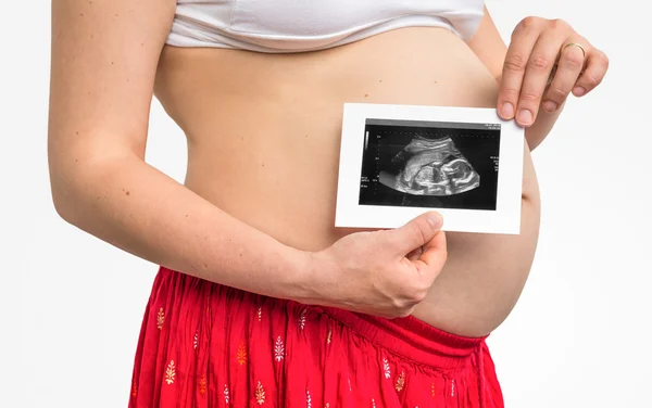 Κοιλιά του μια έγκυος γυναίκα και ο υπέρηχος με μωρό — Φωτογραφία Αρχείου