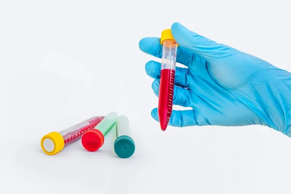 Mão dos cientistas segurando um tubo de teste com sangue — Fotografia de Stock