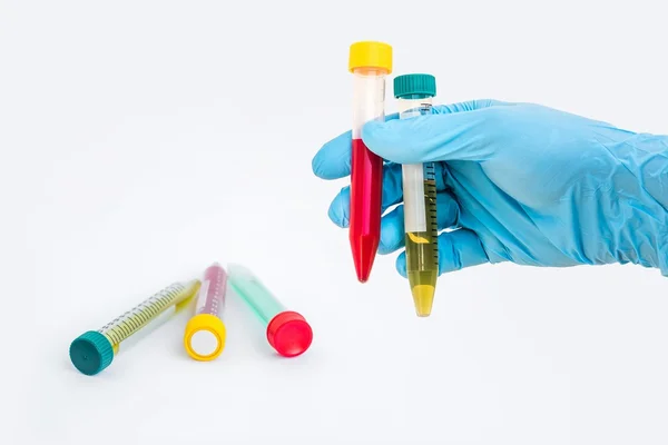 Mão segurando um tubo de teste com líquido verde e sangue — Fotografia de Stock