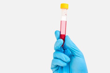 Boş etiket için kan örneği ile tüp