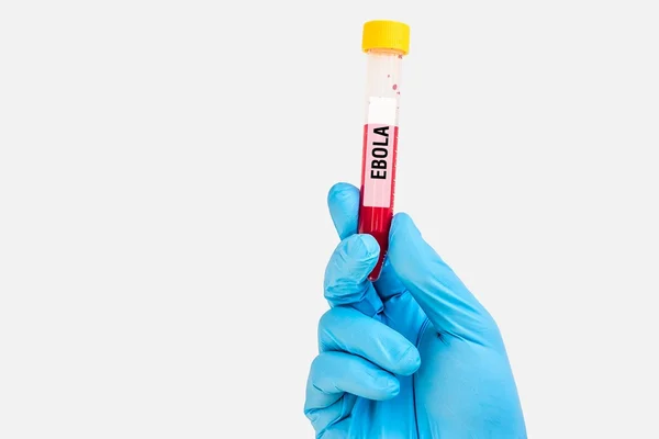 에볼라 테스트에 대 한 혈액 샘플 시험 관 — 스톡 사진