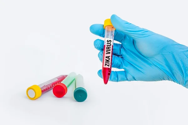 Zika 바이러스 테스트에 대 한 혈액 샘플 시험 관 — 스톡 사진