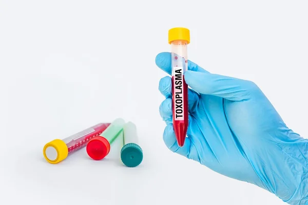 Test-tube with blood sample for TOXOPLASMA test — Stock Photo, Image