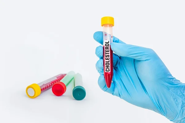 Test-tube with blood sample for CHOLESTEROL test — Stock Photo, Image