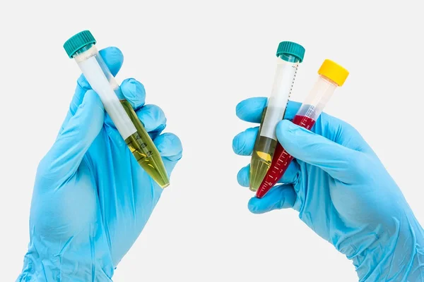 Тестовая трубка в руке с зеленой жидкостью и кровью — стоковое фото