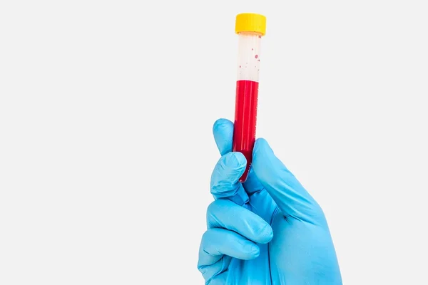 Test-tube in hand with blood