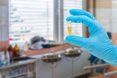 Yakın çekim yansımalar bilim adamı elinde yeşil sıvı ile