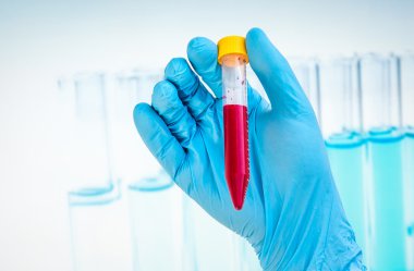 Kan testi için kan örneği ile tüp