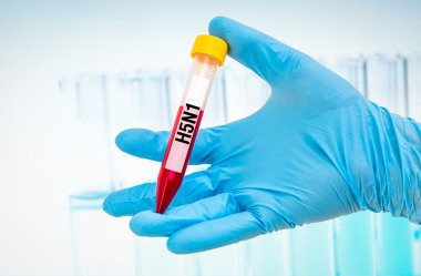 H5n1 testi için kan örneği ile tüp