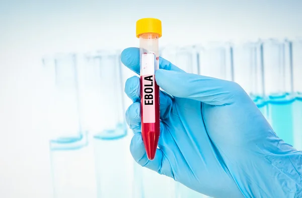 Δοκιμαστικό σωλήνα με δείγμα αίματος για δοκιμή Έμπολα — Φωτογραφία Αρχείου