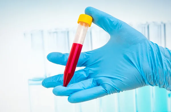 Tubo di prova con campione di sangue per il test BLOOD — Foto Stock