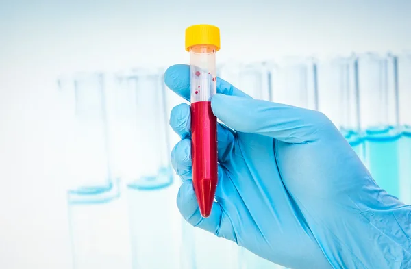 Tubo di prova con campione di sangue per il test BLOOD — Foto Stock