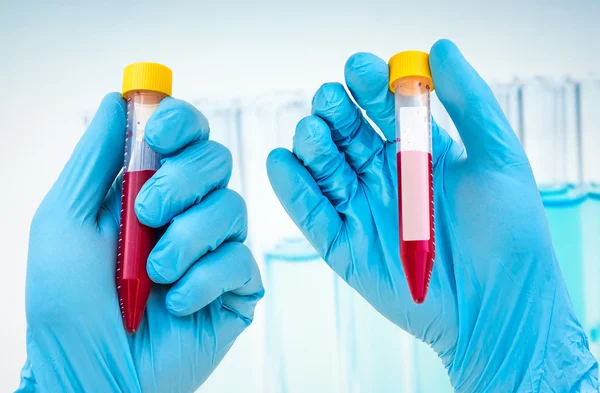Tubo di prova con campione di sangue per etichetta bianca — Foto Stock