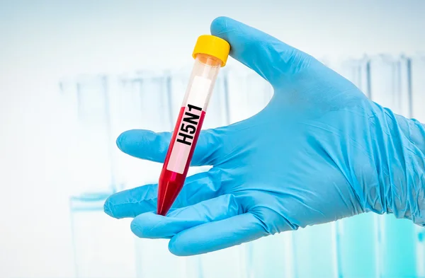 Provrör med blodprov för H5n1 test — Stockfoto