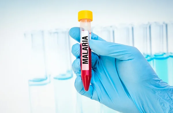Тестовая трубка с образцом крови для теста MALARIA — стоковое фото