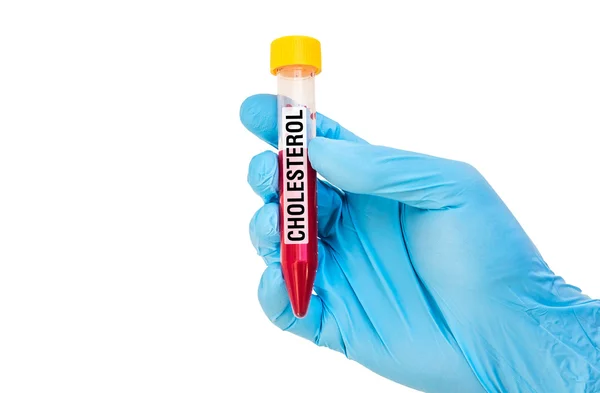 Test-tube with blood sample for CHOLESTEROL — Stock Photo, Image