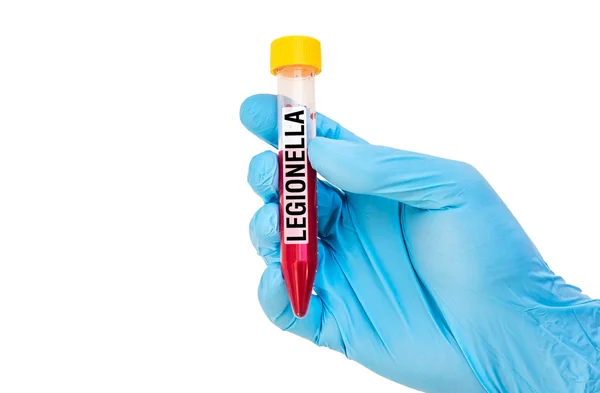 Test-tube with blood sample for LEGIONELLA — Stock Photo, Image