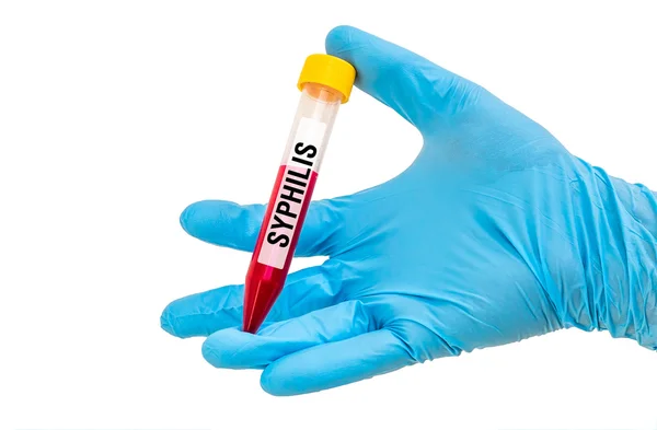 Tubo de ensayo con muestra de sangre para SÍFILIS —  Fotos de Stock