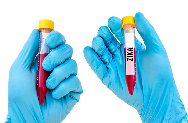 Zika의 혈액 샘플 시험 관 — 스톡 사진
