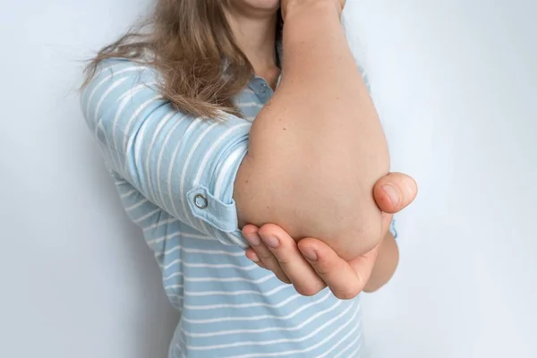 Žena Bolestí Lokte Drží Svou Bolavou Paži Tělo Koncepce Bolesti — Stock fotografie