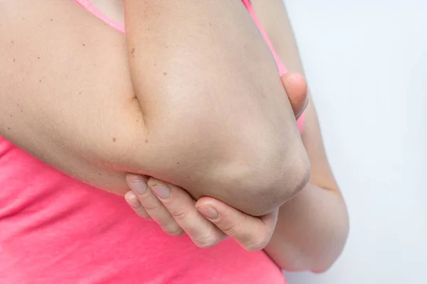 Mujer Con Dolor Codo Sostiene Brazo Dolorido Concepto Dolor Corporal — Foto de Stock