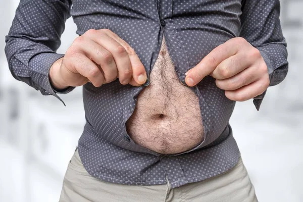 Dicker Bauch Des Mannes Der Nicht Unter Das Hemd Passt — Stockfoto