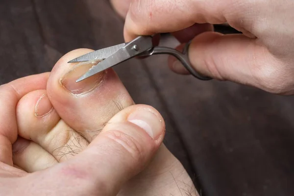 Человек Стрижет Ногти Ноге Концепция Педикюра — стоковое фото