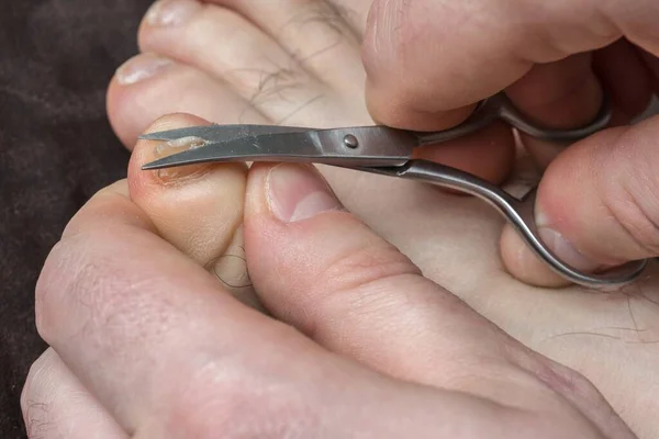 Man Knipt Nagels Aan Zijn Voet Pedicure Concept — Stockfoto