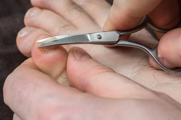Человек Стрижет Ногти Ноге Концепция Педикюра — стоковое фото