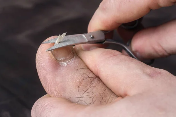 Человек Стрижет Ногти Ноге Концепция Педикюра Стоковое Изображение