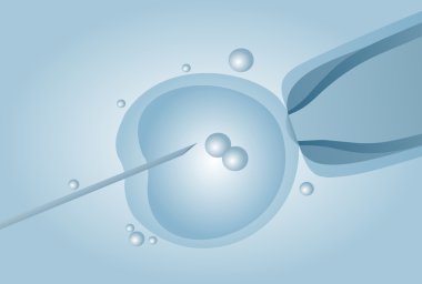 In vitro döllenme IVF mikroskobik suni tohumlama