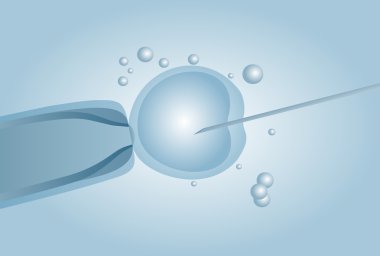 In vitro döllenme IVF mikroskobik suni tohumlama