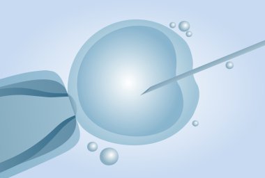 In vitro döllenme IVF mikroskobik suni tohumlama