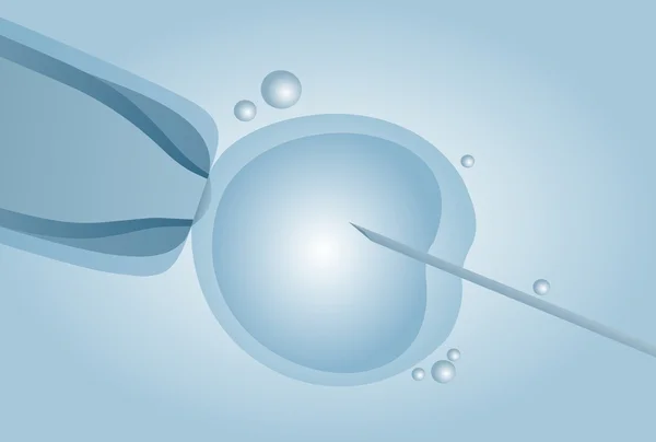 Inseminação artificial microscópica, fertilização in vitro FIV — Vetor de Stock