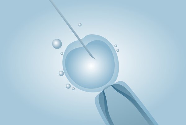Microscopic artificial insemination, In vitro fertilisation IVF