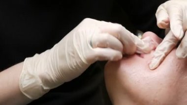 Kozmetoloji kliniğindeki dudak rengini düzelten özel renk pigmentli mikro patenli dudak dövmesi. Eller, dövme makinesiyle dudaklara pigment makyajı uygulayarak kalıcı makyaj yapar.