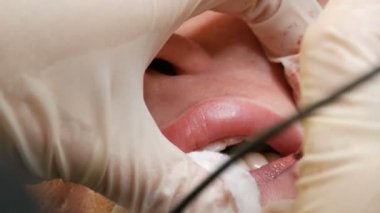 Kozmetoloji kliniğindeki dudak rengini düzelten özel renk pigmentli mikro patenli dudak dövmesi. Eller, dövme makinesiyle dudaklara pigment makyajı uygulayarak kalıcı makyaj yapar.