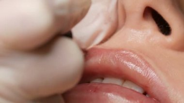 Kozmetik uzmanı, dövme makinesi pembe pigmenti kullanarak dudaklarını mikro patinaj yaptırıyor. Kadın dudaklarına pigment makyajı yapan bir güzellik uzmanı. Güzellik salonunda güzellik endüstrisi kavramı