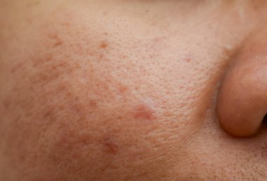 Doğal Cilt Detayları: Yüz Derisi Dokusunun Yakın Çekimi Renklendirme Benekleri ve Gözenekleri