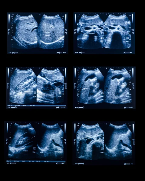 Sonografie horní břicho lékařské vyšetření — Stock fotografie