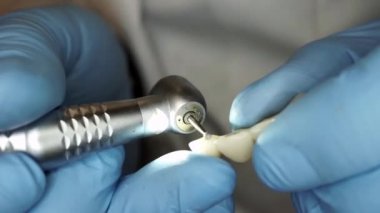 Eldiven diş hekimi diş protez makro ayarlama