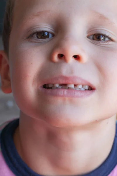 Удаление Молочного Зуба Храбрый Сильный Мальчик Вырывает Себе Зуб Потеря — стоковое фото