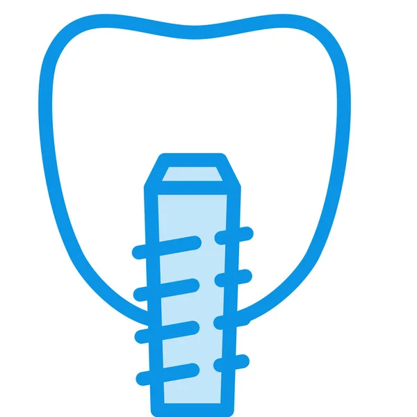 Implanting Screw Tooth Icon Outline Style — Stock Vector