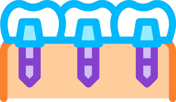 Icono Implantes Dentales Biomateriales Estilo Contorno Rellenado — Archivo Imágenes Vectoriales