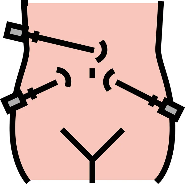 Ikona Chirurgii Bariatrycznej Laparoskopii — Wektor stockowy