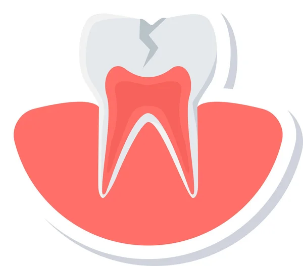 Cavity Tooth Dental Icon Flat Style — Stock Vector