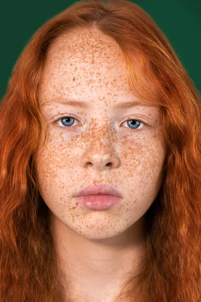 Porträtt Rödhårig Flicka Med Massor Fräknar Ansiktet Och Blå Ögon — Stockfoto