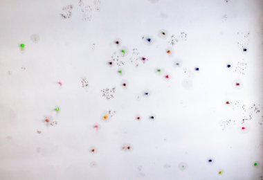 Tavandaki diş etleri