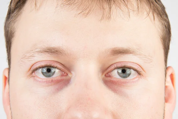 Adamın yorgun gözlerini