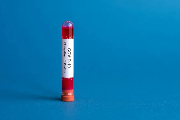 Tubo Ensayo Lleno Una Muestra Sangre Para Análisis Concepto Epidémico — Foto de Stock